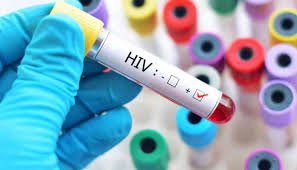 Sindh Reports 894 New HIV Cases in Three Months, Raising Alarm Over Healthcare Safety Gaps